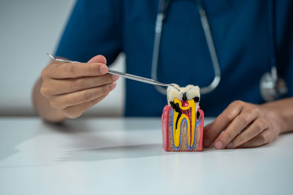 cuánto dura una endodoncia