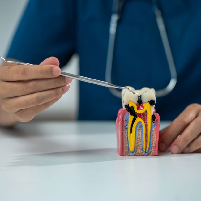 cuánto dura una endodoncia